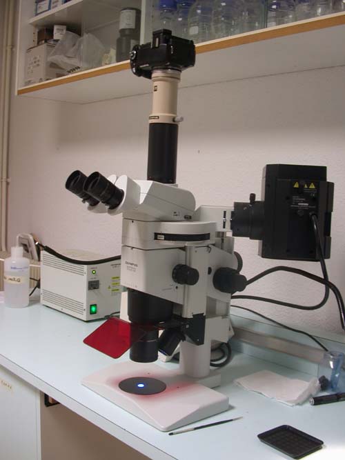 Epifluorescence Epifluorescence